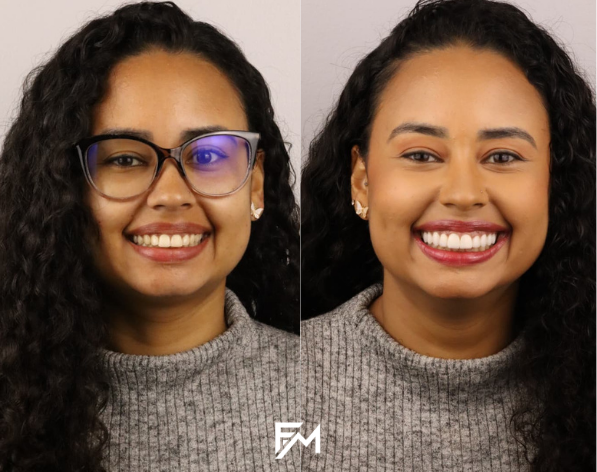 Existe um procedimento que transforma não só sua estética mas sua qualidade (2)