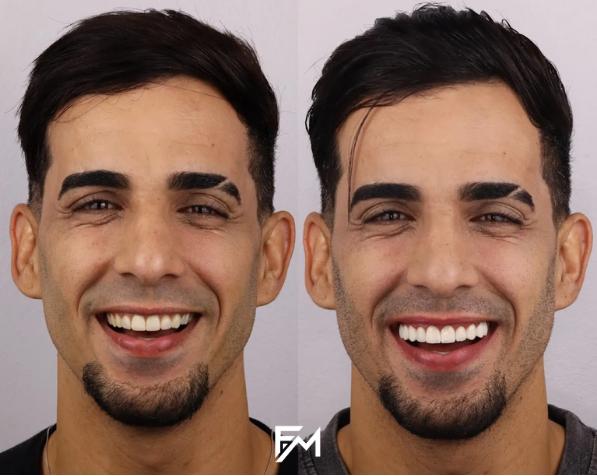 Existe um procedimento que transforma não só sua estética mas sua qualidade (3)